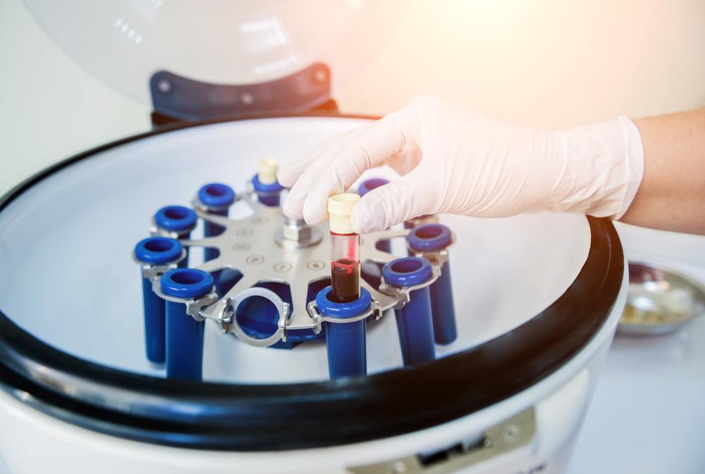 PRP vs. PRF What Is the Real Difference?