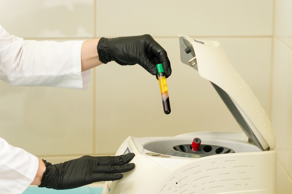 PRP Price Guide in Fairfax