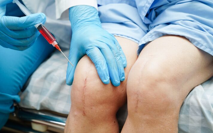 PRP for Knee Pain and Prices in Arlington, VA: What You Need to Know