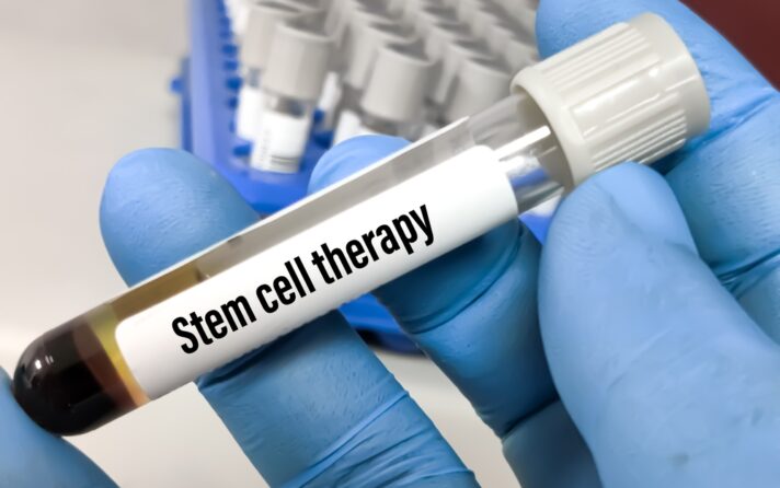 Best Stem Cell Therapy in Arlington, VA: What It Can Treat & How to Find a Reputable Provider