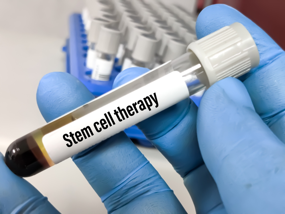 Best Stem Cell Therapy in Arlington, VA: What It Can Treat & How to Find a Reputable Provider