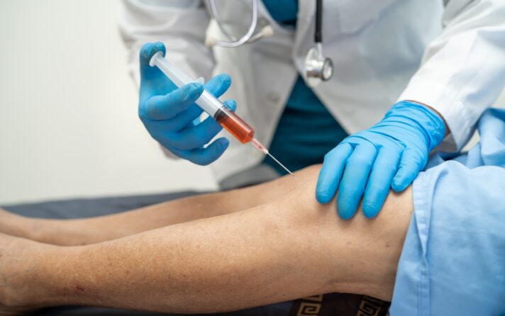 PRP Injections in Vienna: What It Costs to Treat Joint Pain