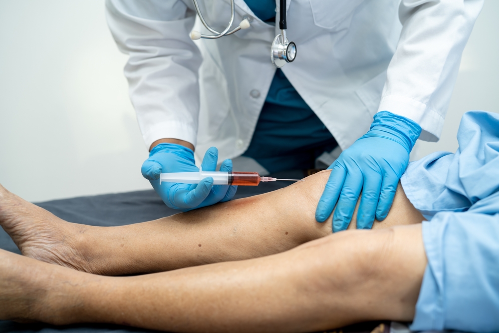 Managing Chronic Pain with PRP in Leesburg: A Cost Guide for Patients