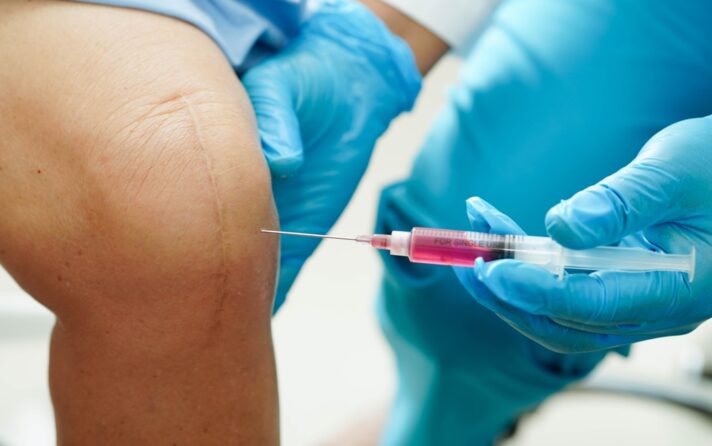 How Much Does PRP Cost in Charlottesville for Pain Management