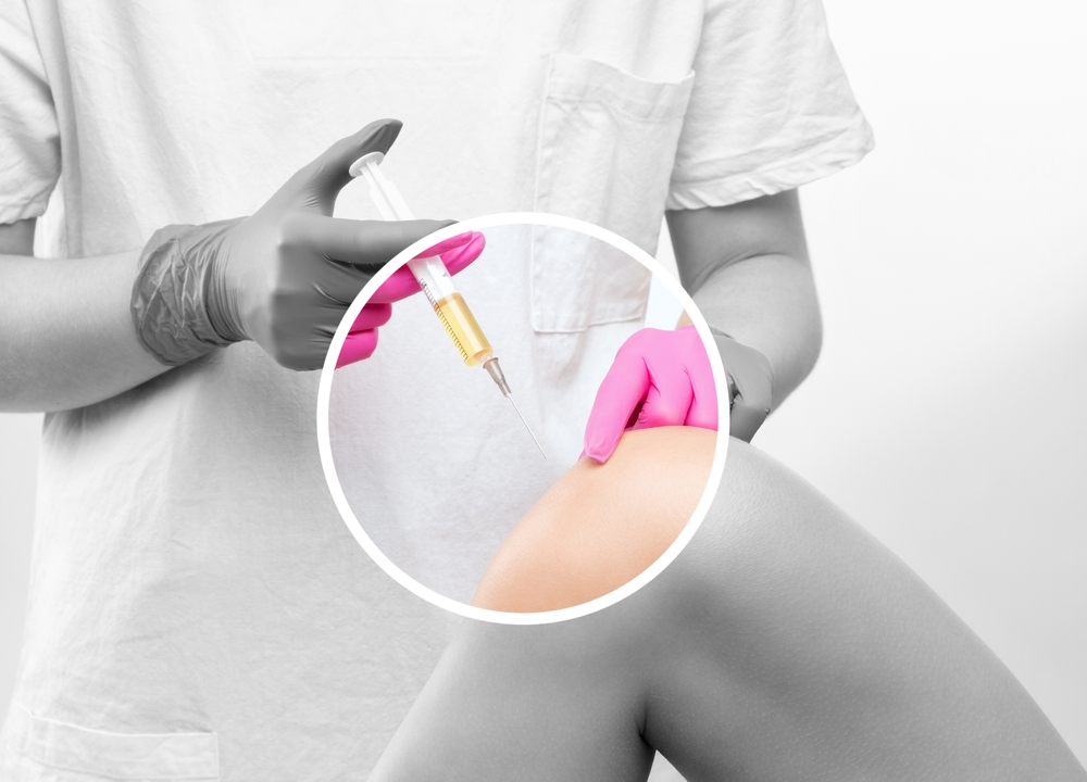 Affordable PRP Treatment Options in Clarendon, VA 