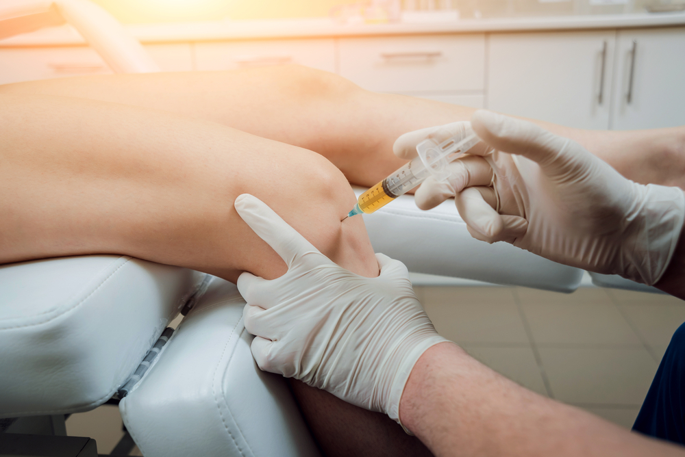 PRP Therapy Benefits for Knee Arthritis in Fairfax, Virginia