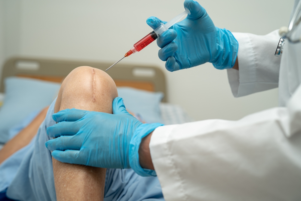Best Stem Cell Doctor for Chronic Joint Pain in Fairfax, Virginia