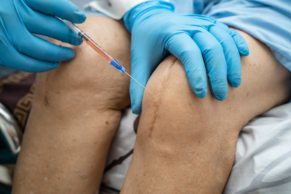 PRP Arthritis Treatment Consultation Near Arlington, Virginia